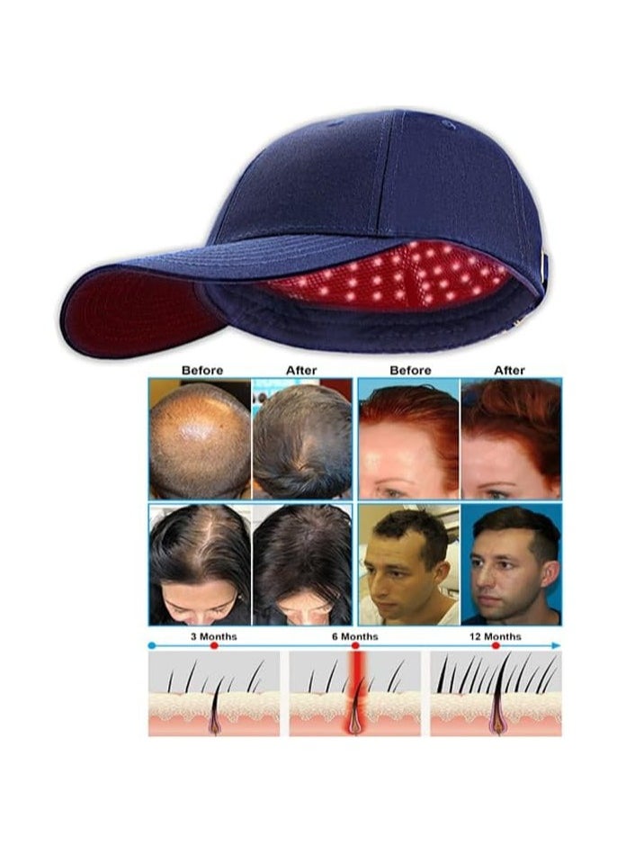 General Hair Growth Cap Anti-Hair Loss Helmet Electric Scalp Massager Infrared Light Therapy Hair Regrowth Treatment Hair Restoration Anti-thinning Cap Hair Loss Therapy  - Image 3
