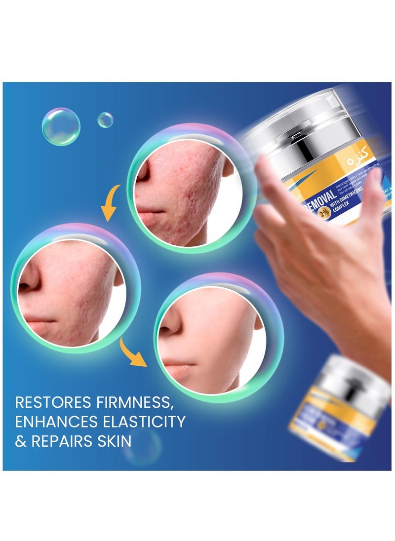 Kanza - 50ml Scar Removal Cream for Damaged Skin Dead Skin Elimination New & Old Scars Removal Cream Herbal Extracts Infused Burns Repair Face and Body Skin Repair Cream Unisex - Image 1