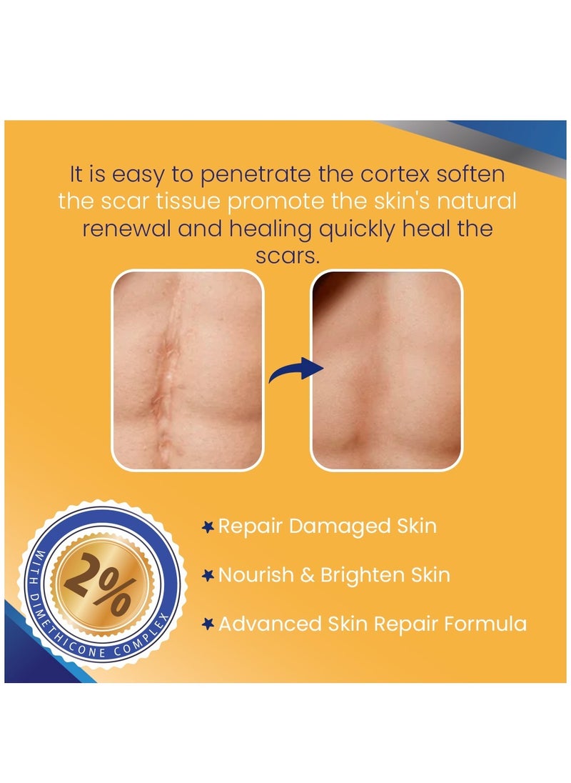 Kanza - 50ml Scar Removal Cream for Damaged Skin Dead Skin Elimination New & Old Scars Removal Cream Herbal Extracts Infused Burns Repair Face and Body Skin Repair Cream Unisex - Image 1