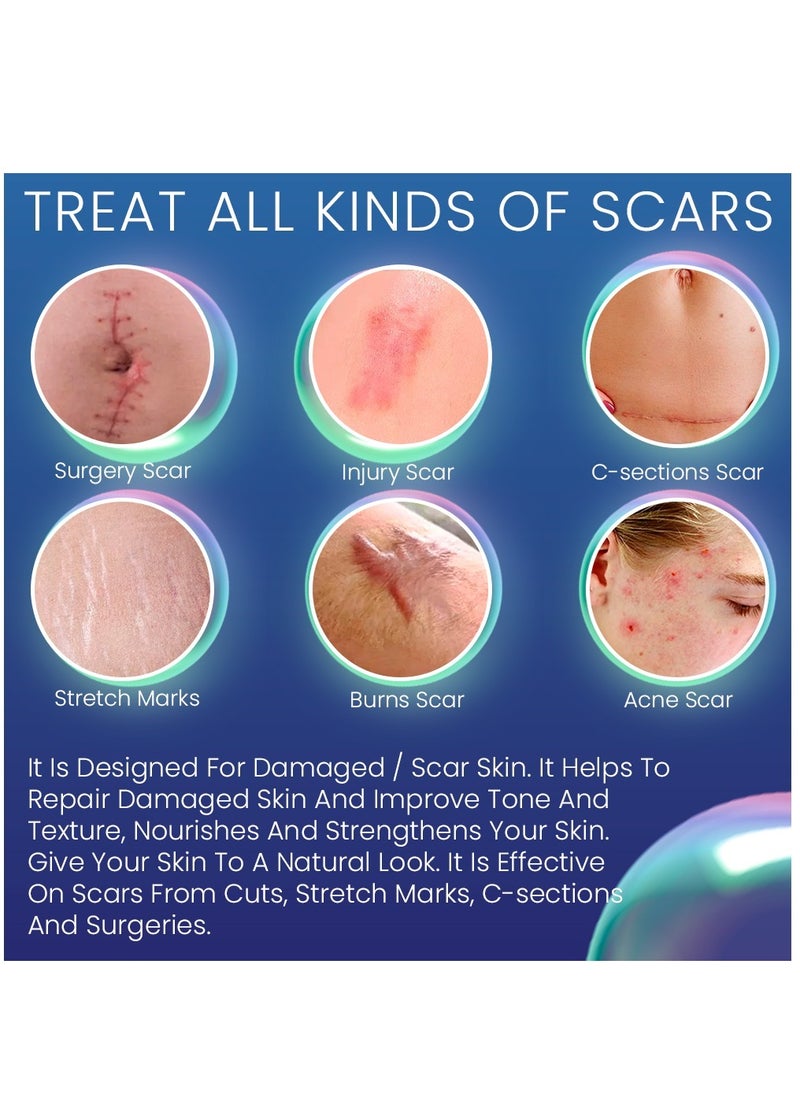 Kanza - 50ml Scar Removal Cream for Damaged Skin Dead Skin Elimination New & Old Scars Removal Cream Herbal Extracts Infused Burns Repair Face and Body Skin Repair Cream Unisex - Image 1