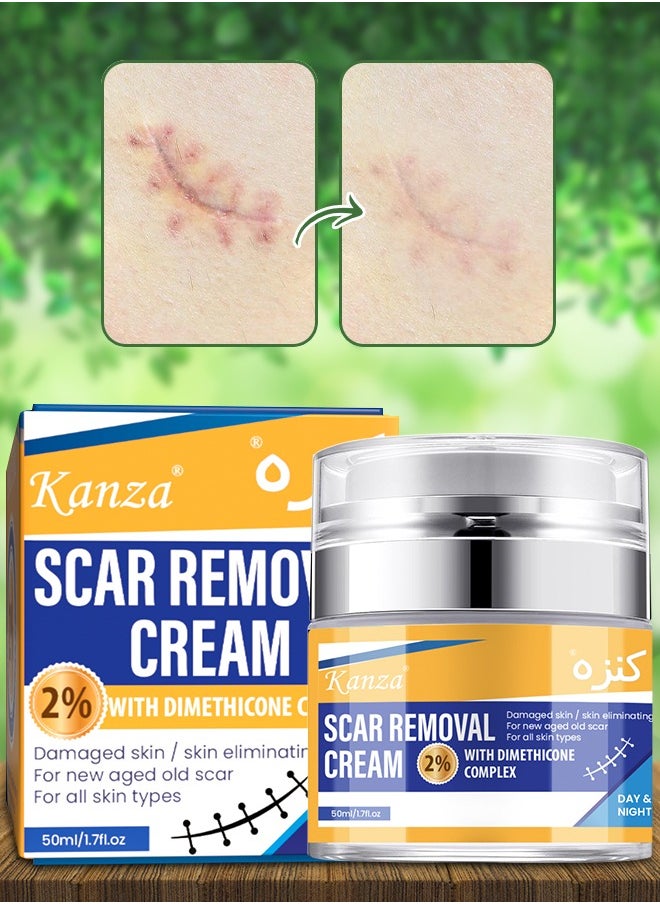 Kanza - 50ml Scar Removal Cream for Damaged Skin Dead Skin Elimination New & Old Scars Removal Cream Herbal Extracts Infused Burns Repair Face and Body Skin Repair Cream Unisex - Image 1