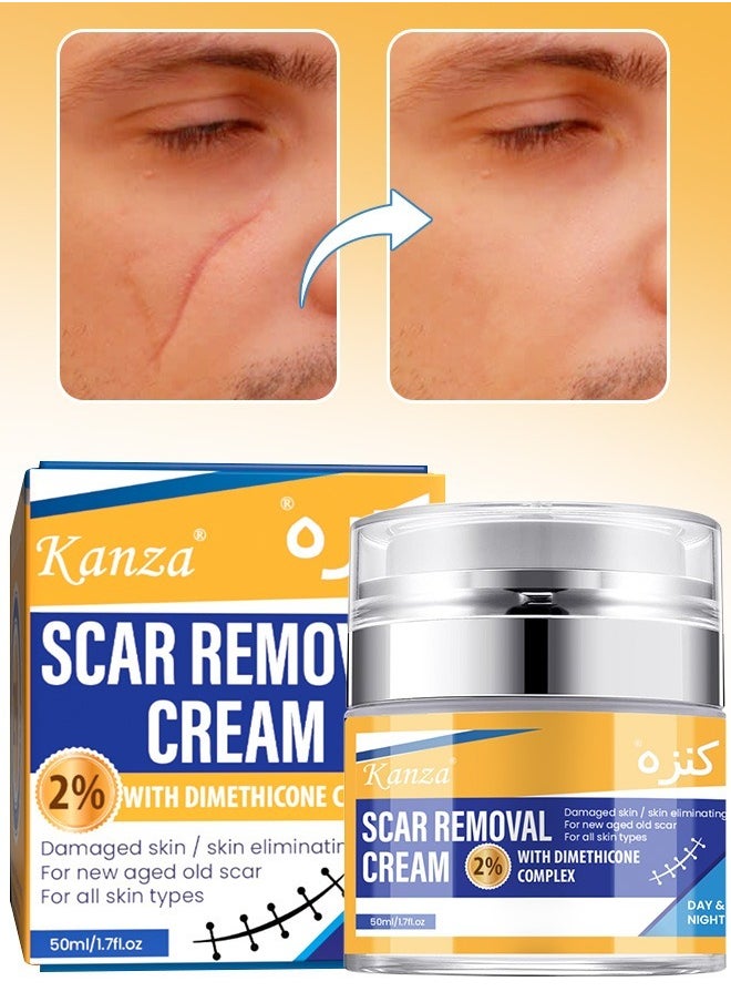 Kanza - 50ml Scar Removal Cream for Damaged Skin Dead Skin Elimination New & Old Scars Removal Cream Herbal Extracts Infused Burns Repair Face and Body Skin Repair Cream Unisex - Image 1