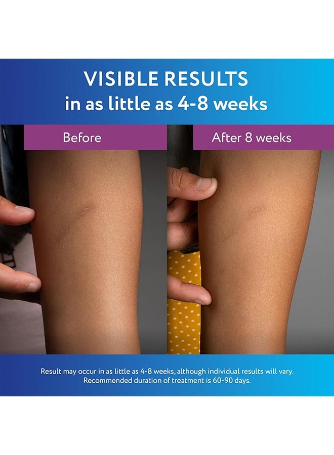 scaraway Silicone Scar Gel - Helps Improve Size - Color & Texture of Hypertrophic & Keloid Scars from Injury, Burns & Surgery, Water Resistant, 20g (0.7 Oz) - Image 3