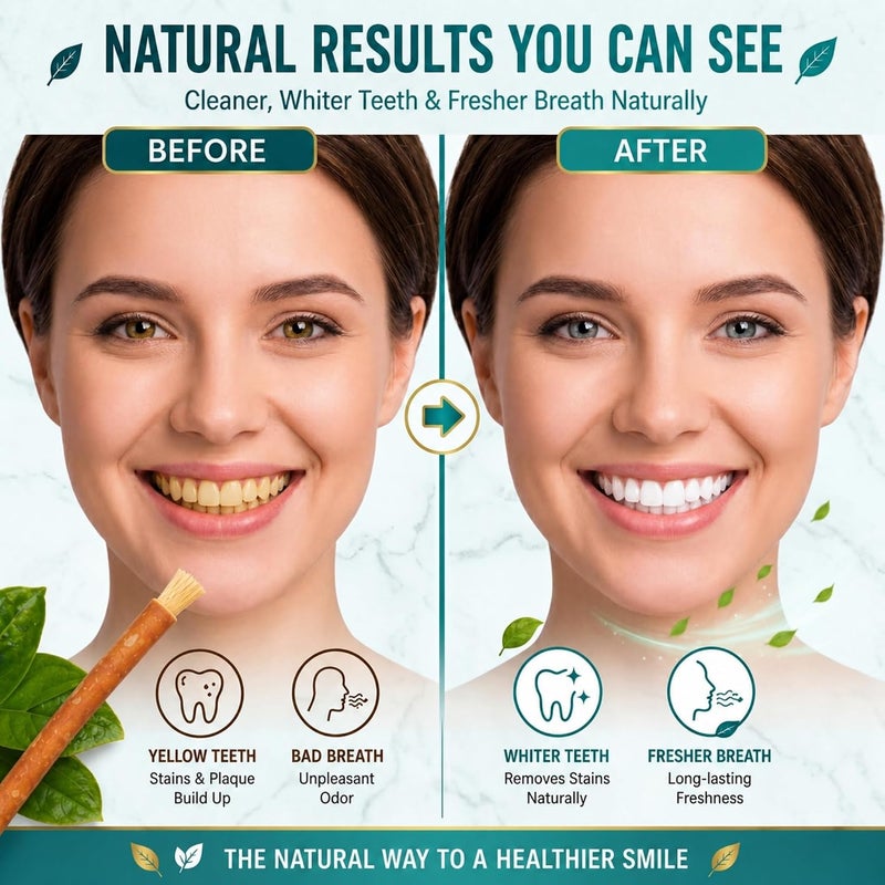 Natural Stick| maswak Chewable Toothbrush | Organic Teeth Cleaning & Whitening | Tooth Brush | 03 with one Holder | Vacuum Sealed for Freshness | Oral Care & Healthy Gums - Image 4
