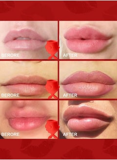 VILILY Lip Plumper Device Enhancer Fish-Shaped Lip Plumper Enhancer Full Lips Enhancement Improving Drooping Lips Enlargement Tools Trainer For Makeup Women Girls  - Image 5