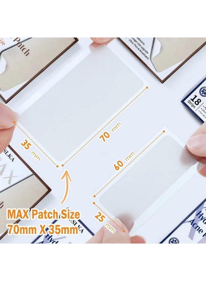 AUSLKA Large Blemish Zit Patches XL - 20 Strips - Hydrocolloid Dots -Blemishes Patch - Zit Breakouts - Blemishes Stickers - Max Size - Image 4