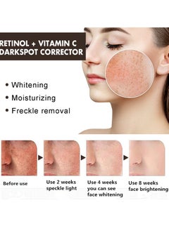 EELHOE Dark Spot Remover for Face Retinol and Vitamiin C Dark Spot Corrector Remover Cream to Remove Dark Spots and Melasma Remover Whitening Moisturizing  - Image 2