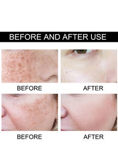 EELHOE Dark Spot Remover for Face Retinol and Vitamiin C Dark Spot Corrector Remover Cream to Remove Dark Spots and Melasma Remover Whitening Moisturizing  - Image 3