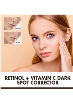 EELHOE Dark Spot Remover for Face Retinol and Vitamiin C Dark Spot Corrector Remover Cream to Remove Dark Spots and Melasma Remover Whitening Moisturizing  - Image 4