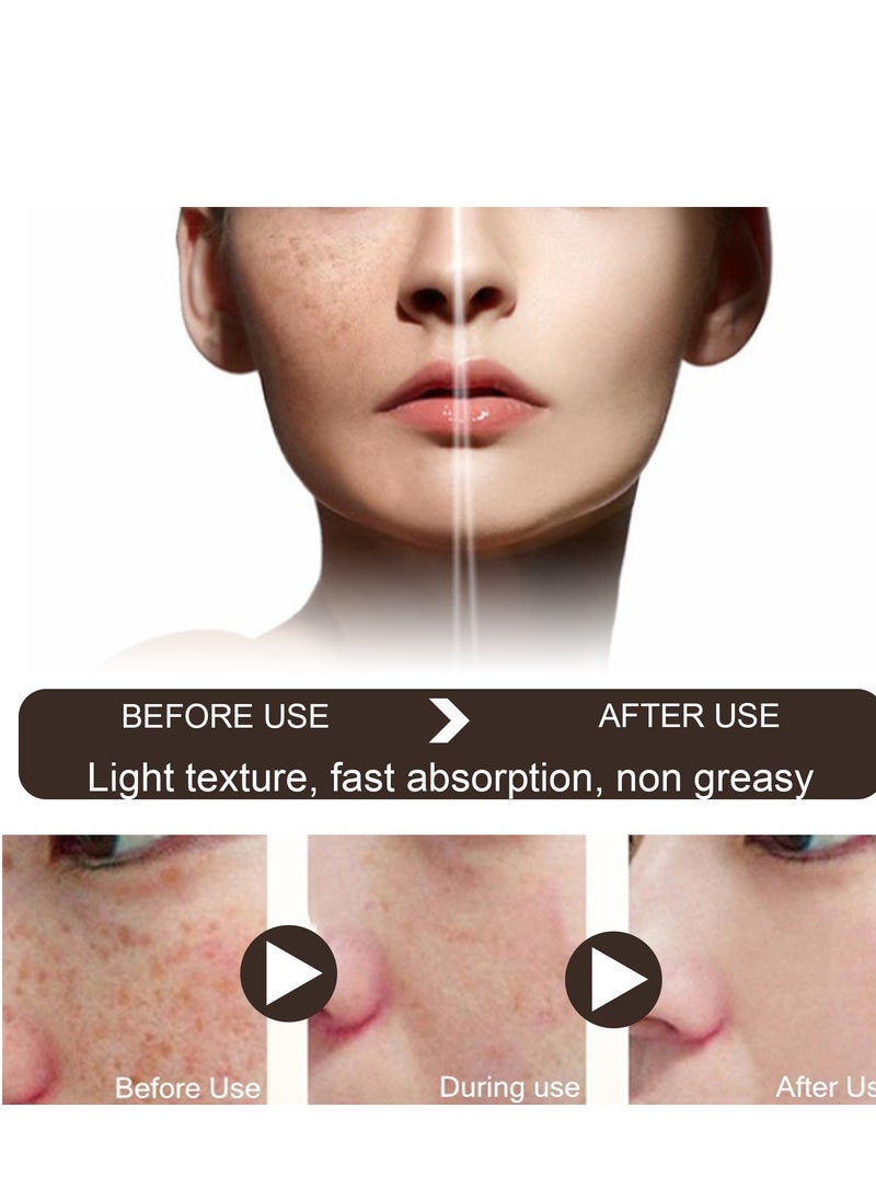 EELHOE - Dark Spot Remover for Face Retinol and Vitamiin C Dark Spot Corrector Remover Cream to Remove Dark Spots and Melasma Remover Whitening Moisturizing - Image 1