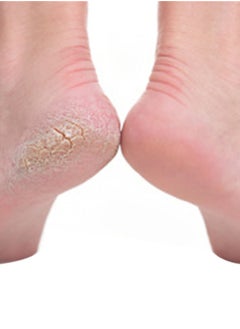 NIBEMINENT Foot File Pack Pink/Black  - Image 2