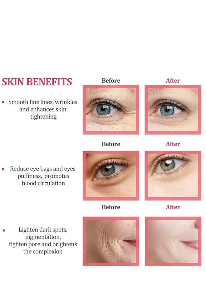 إسكدنيا الشكل الوردي الفريد لقرص الثلج للوجه، تدليك الوجه الجميل، مكعب متوهج للوجه، أدوات العناية بالبشرة لتجاعيد العين، تخفيف انتفاخ حب الشباب (أصفر) - Image 5