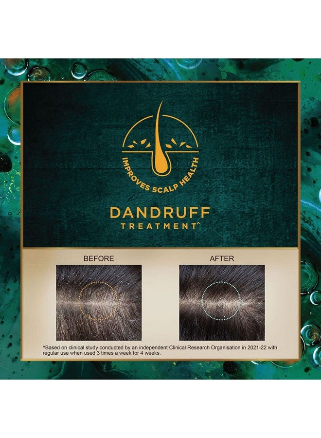 إندوليكا زيت إندوليكا سفيتاكوتاجا | زيت طبي أيورفيدي لعلاج قشرة الرأس | زيت أيورفيدي 100% | 50 مل - Image 3