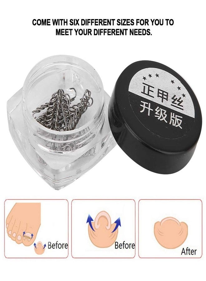 Horoper Nail Ingrowing Corrector, Nail Corrector Wire, Ingrown Toenail Correction Corrector,12Pcs/Box Toenail Correction Tool 6 Sizes Ingrown Wire Fixer Toe Nail Recover Ingrown Toe Nail Correction Tool (#3) - Image 5