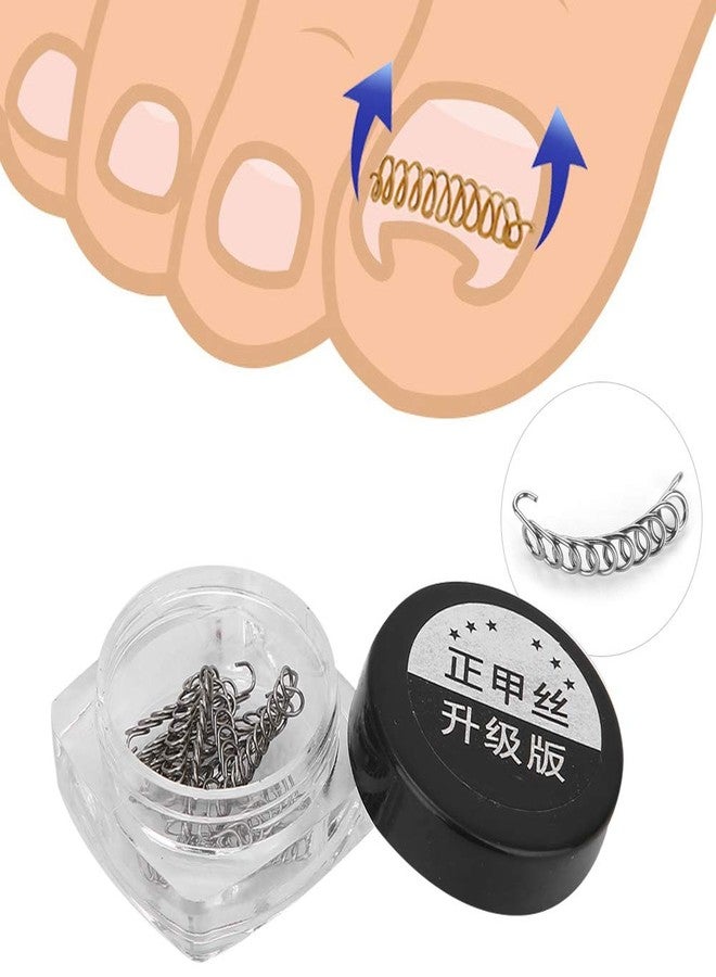 Horoper Nail Ingrowing Corrector, Nail Corrector Wire, Ingrown Toenail Correction Corrector,12Pcs/Box Toenail Correction Tool 6 Sizes Ingrown Wire Fixer Toe Nail Recover Ingrown Toe Nail Correction Tool (#3) - Image 2