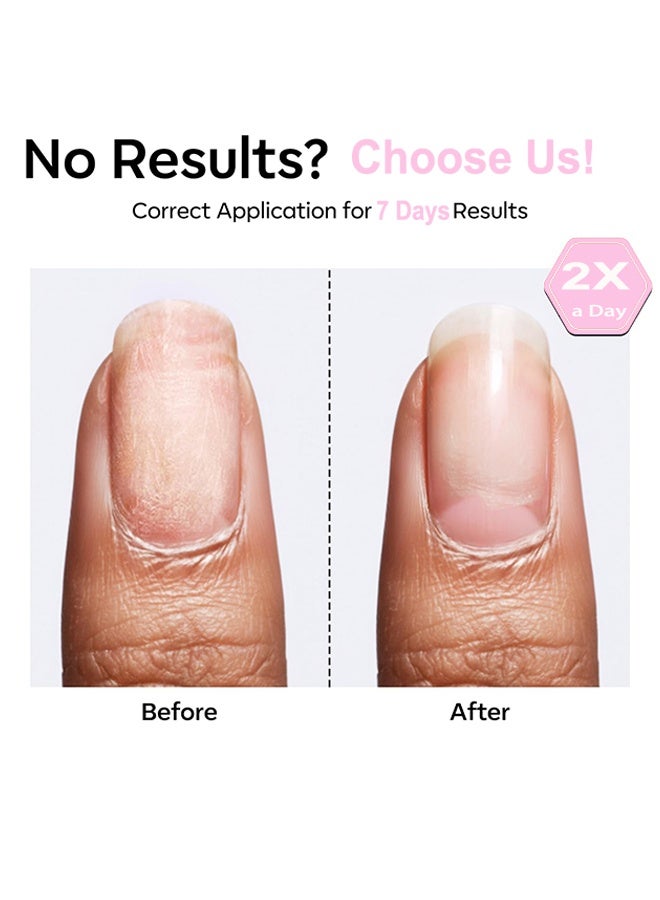 أيدول مقوي الأظافر، محلول مغذي للأظافر لعلاج نمو الأظافر، طلاء لتقوية الأظافر الهشة والمتضررة، سيروم الأظافر للقوة والإصلاح، مقوي الأظافر للعناية بالأظافر - Image 4