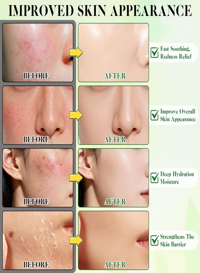 HORSEFISH TOOL Madecassoside Toner Pads, Facial Exfoliating Pads, Redness Reducing Skin Care, Hydrating Pore Care, Toner Pads for Acne Prone, Oily, Clogged Skin, Non Comedogenic, Ideal for All Skin, 110 Pads - Image 3