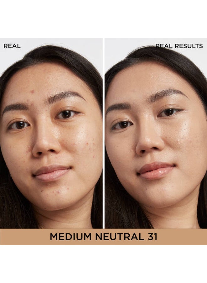 آي كوزمتيكس آي تي ​​كوزماتيكس - خافي عيوب + سيروم للبقع الداكنة - تغطية متوسطة - 31 - متوسط ​​- محايد - 6.7 مل - Image 3