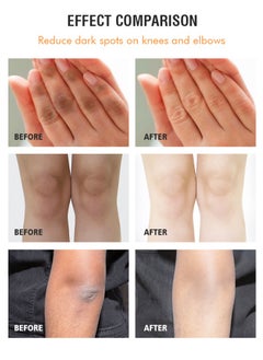 MOOYAM Dark Knuckle Remover Dark Spot Corrector Dark Underarm Cream Body Cream Lotion Dark Spot Remover Removal for Armpit Knees Elbows Inner Thigh Private Parts Intimate Skin Cream 4.21floz/120g  - Image 2