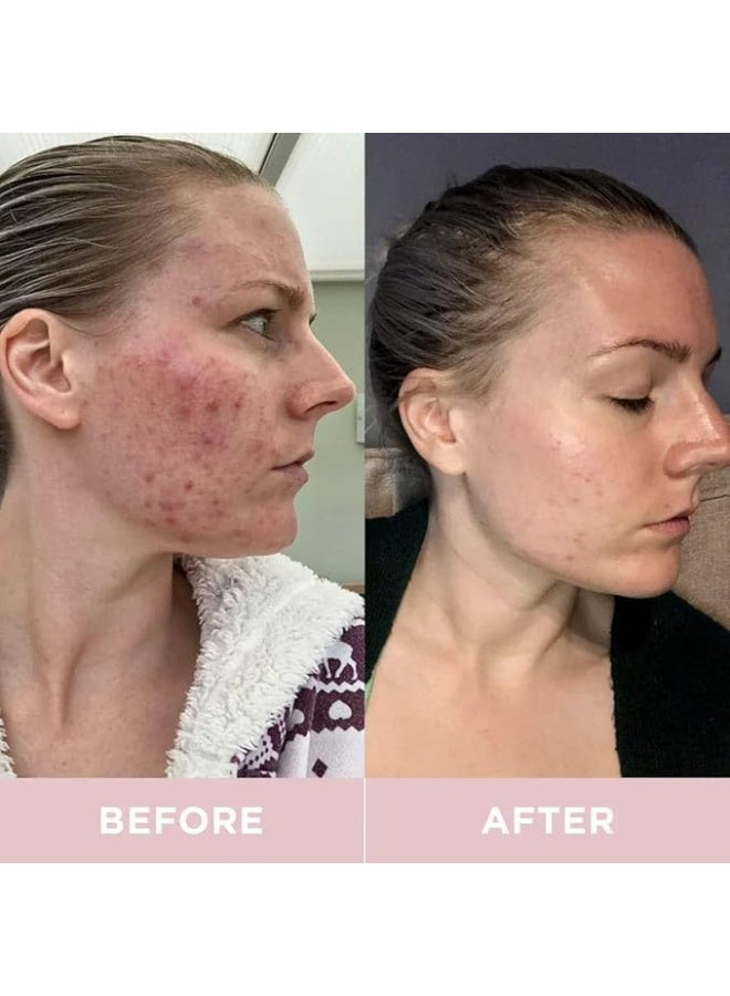 Revive Collagen Original 22G Sach 28S - Image 3