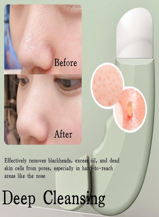 KINTEGOOD Blackhead Remover Tool, Reusable Face Spatula Scrubber for Deep Cleansing, Skin Care Tool for Men and Women, Green - Image 3