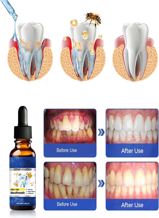 WUIAOCIT 2PCS Beerakt Oral Repair Solution, Mint Flavored Oral Mouthwash，Effectively Improves Oral Hygiene & Long-Lasting Fresh Breath，Daily Oral Care Solution - Image 4