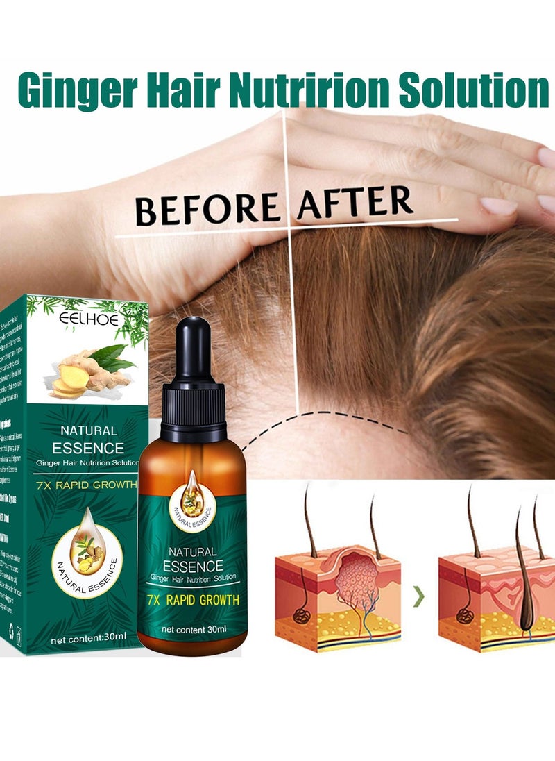 EELHOE - Ginger Germinal Oil, Rapid Growth Hair Treatment 7 Day Hair Growth Serum Essence Oil Regrow, Ginger Essential Oil Stop Hair Loss Hair, Thinning Treatment Hair Growth Oil for Women & Men 30ML - Image 1