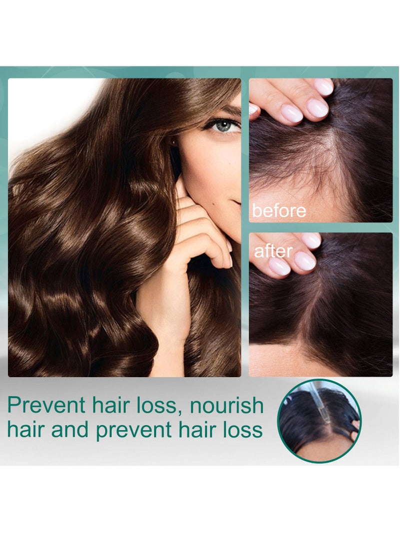 EELHOE - Ginger Germinal Oil, Rapid Growth Hair Treatment 7 Day Hair Growth Serum Essence Oil Regrow, Ginger Essential Oil Stop Hair Loss Hair, Thinning Treatment Hair Growth Oil for Women & Men 30ML - Image 1