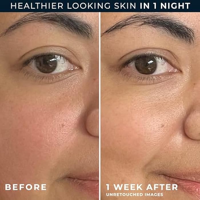 RoC Barrier Renew Night Moisturizer with Ceramides & Antioxidant Green Tea and Lipo Peptides to Renew Skin Barrier, (2.5 oz) with Retinol Eye Cream Packette - Image 5