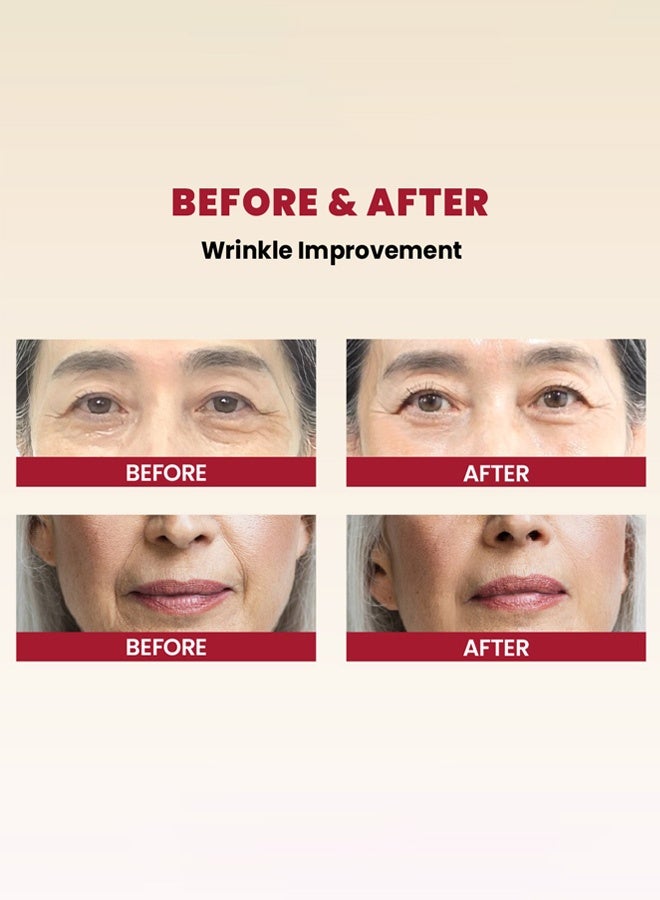 سيول 1988 كريم سيول 1988 بحبيبات ريتينول - 1% ريتينول محاط + أرز مخمر - كريم وجه مضاد للشيخوخة وتفتيح البشرة - مرطب لطيف برتينويد - عناية بالبشرة الكورية 50 مل - Image 5