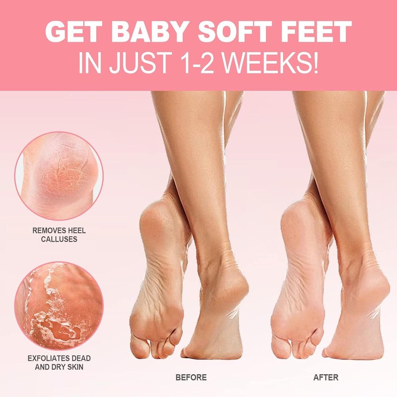 JVR Foot Peel Mask - 3 Pairs - Exfoliating Peeling Callus Remover, Repairs Cracked Heels & Dead, Dry Skin, for Smoother and Softer Feet (Rose) - Image 2