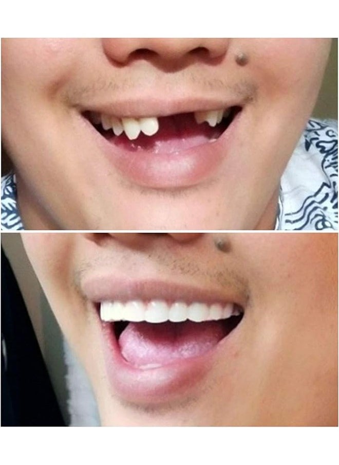 أوشن - ابتسامة مثالية على الوجه العلوي بدلة ، لحظة وهمية على الوجه ابتسامة فورية على الوجه مستحضرات التجميل لتبييض الأسنان بدلة مؤقتة ، وحماية الأسنان بشكل طبيعي مريح ، ومناسبة للرجال والنساء - Image 1
