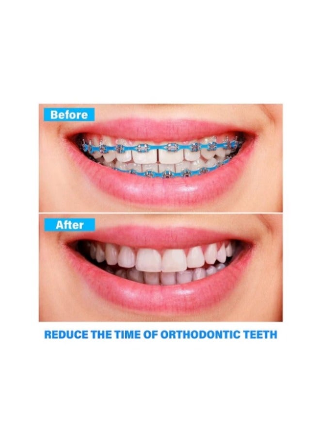 4.57M Orthodontic Rubber Chain, Braces Dynamic Chain (4.0mm) - Image 5