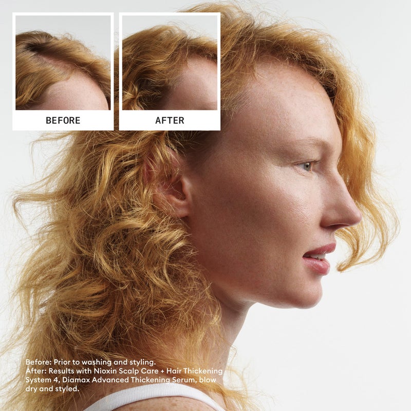Nioxin System 4 Scalp + Hair Thickening Treatment | Serum for Colored or Damaged Hair with Progressed Thinning | 6.8 Fl oz. - Image 3