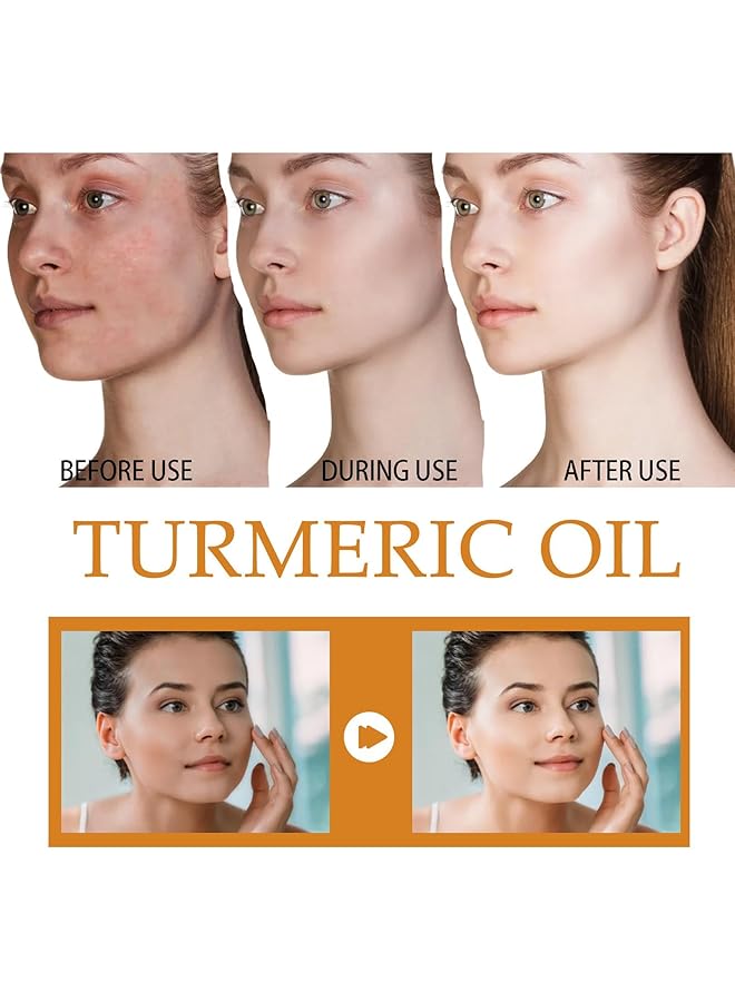 erorex Turmeric Essential Oil Dark Spot Removal And Anti Aging Skin Serum For Women 100 Percent Pure Natural Moisturizing For Body And Face 2Pcs 100Ml Each - Image 4