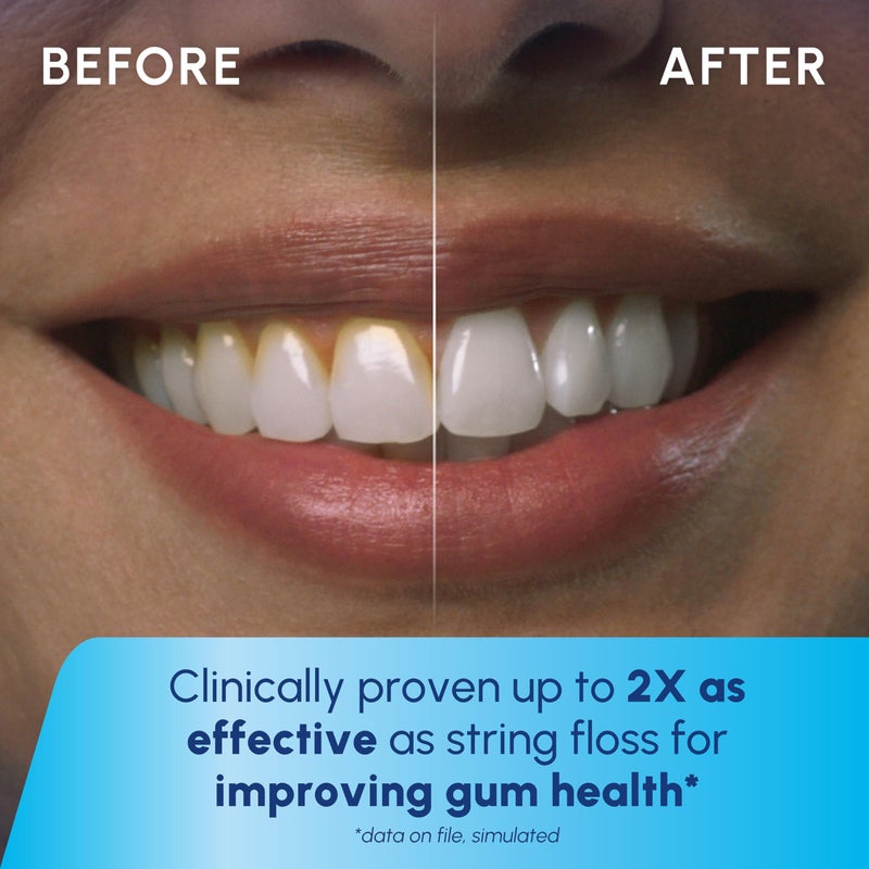 Waterpik Cordless Pearl Rechargeable Portable Water Flosser for Teeth, Gums, Braces Care and Travel with 4 Flossing Tips - ADA Accepted, WF-13 White, Packaging May Vary - Image 5