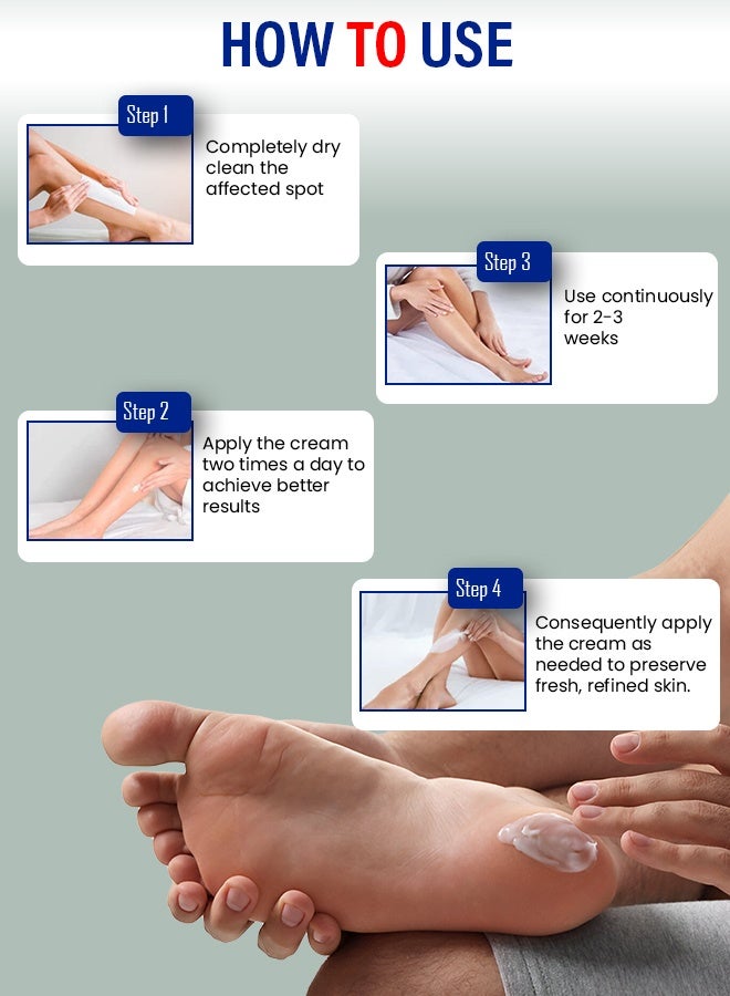 Kanza 40% Urea Cream 150g Upgraded for Cracked Feet Hands Callus Remover Hand Cream Foot Cream for Cracked Foot Heels Elbows Nails Knees Dry Skin Moisturizer Urea Lotion with Maximum Strength for Men and Women - Image 5