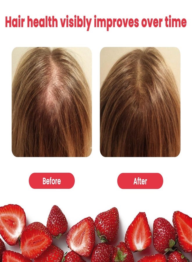 حلوى بيوتين بوتريزن للشعر والبشرة والأظافر - تدعم صحة الشعر - فيتامينات بيوتين نباتية للنساء والرجال، تدعم نمو الشعر بشكل أسرع، وتقوي الأظافر، وتحافظ على صحة البشرة - 60 حبة - Image 4
