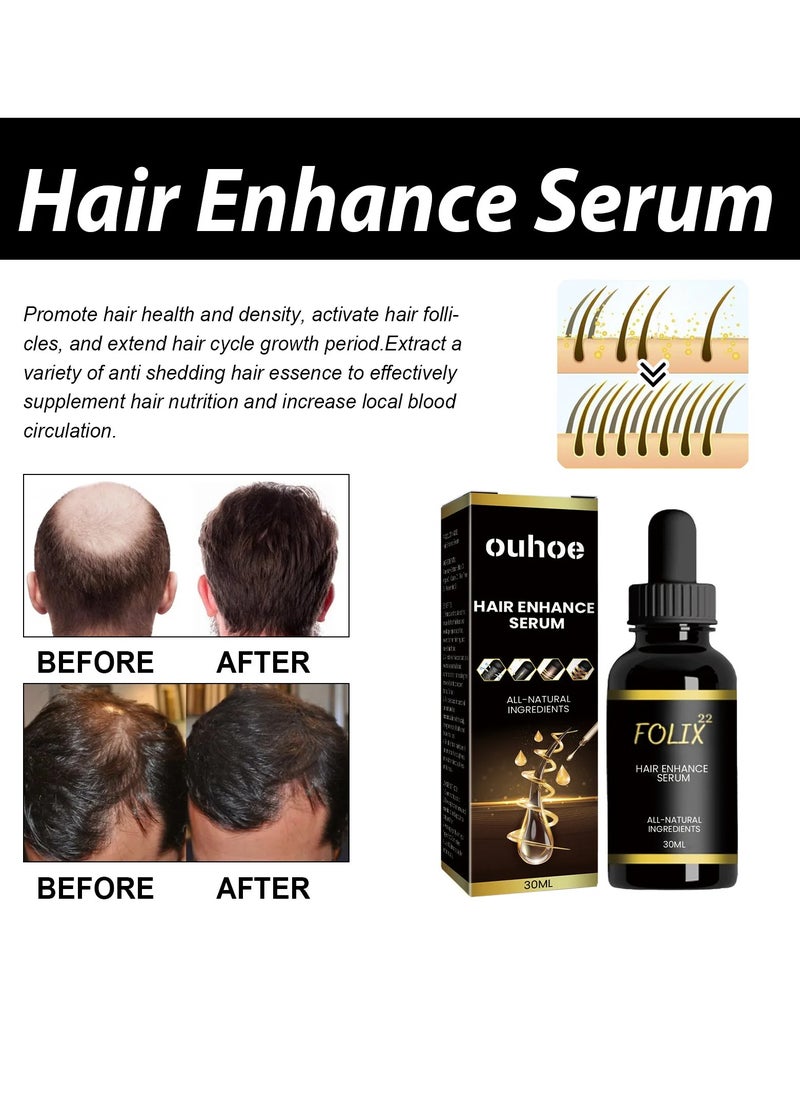 OUHOE - Hair Thickening Serum, Natural Ingredients Hair Growth Oil, Nourishing Hair Growth Scalp Treatment Oil,  Anti Hair Loss Hair Treatment Essence For Thinning And Damaged Hair - Image 1
