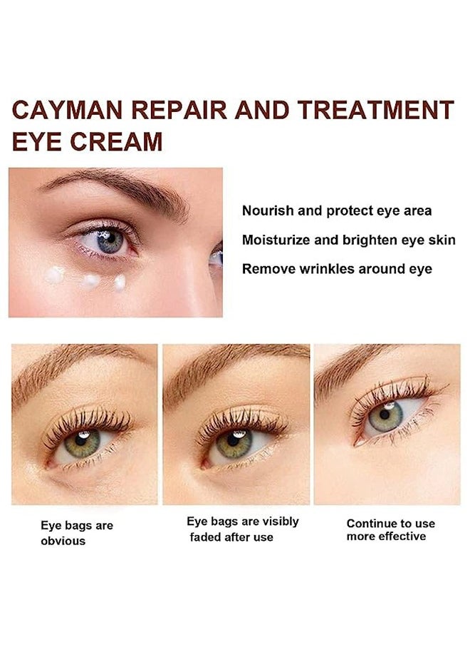 Vibrant Glamour - Magic Eye Cream,Eye Cream to Remove Eye Bags,Wrinkles,Fine Lines,Dark Circles, Anti Aging Eye Cream 0.71 Fl Oz, Repair Lift Lighten Dark Circles - Image 1