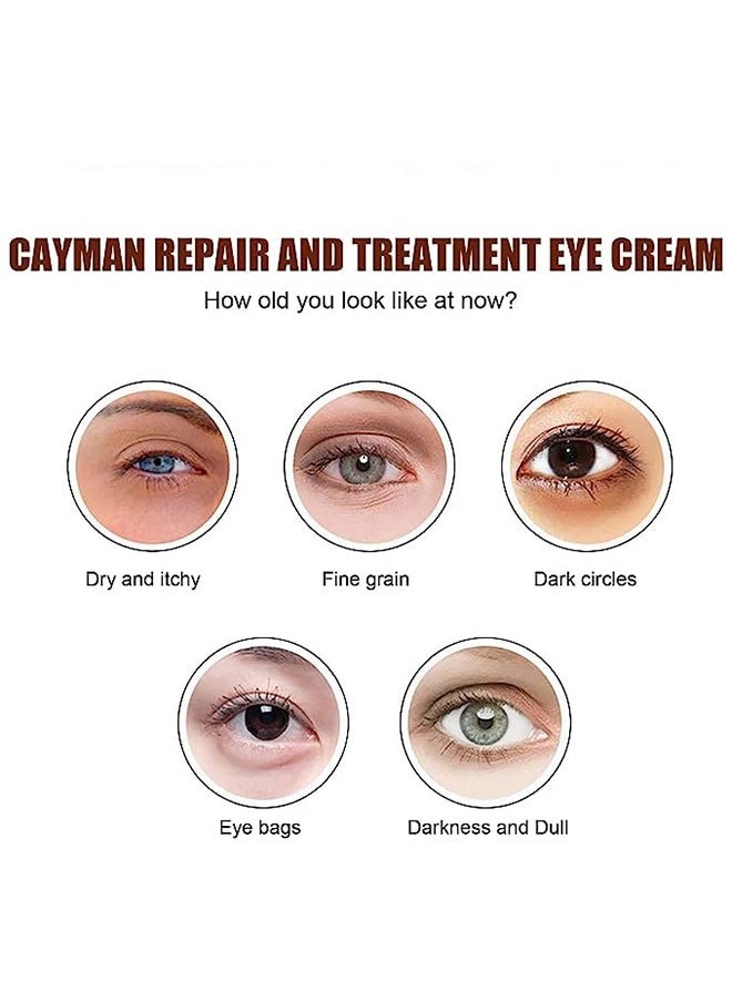Vibrant Glamour - Magic Eye Cream,Eye Cream to Remove Eye Bags,Wrinkles,Fine Lines,Dark Circles, Anti Aging Eye Cream 0.71 Fl Oz, Repair Lift Lighten Dark Circles - Image 1