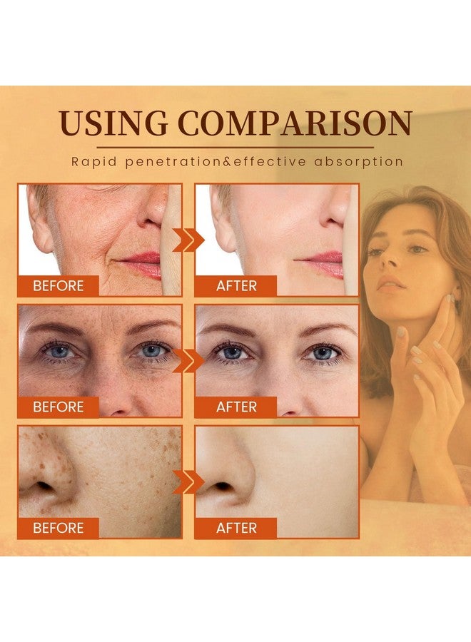 Rosarden Vitamin C Face Serum Vitamin C Serum For Face 100% Pure Vitamin C Serum For Facial Moisturizing Firming Skin And Even Skin Tone 30 Ml - Image 5