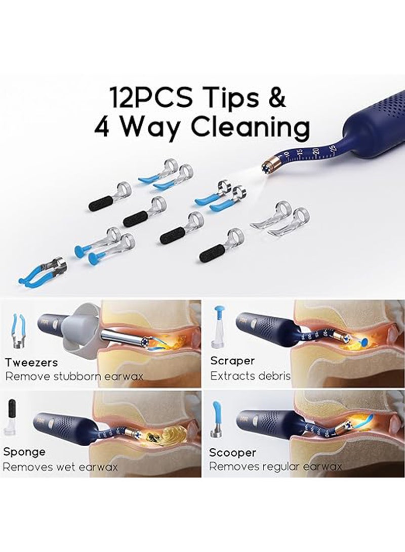 Bebird Earsight Plus: Ear Wax Removal Tool Camera & Light, Visual Earwax Cleaner with Cleaning Kit As Spade/Spoon/Picker/Tweezers Clean Ears for Family, Ear-Scope Wireless WiFi Connect (Dark Blue)  - Image 3