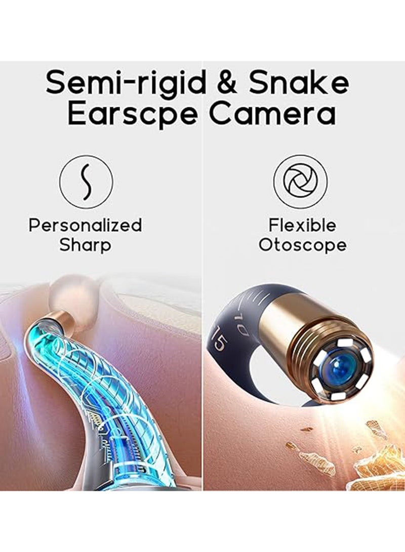 Bebird Earsight Plus: Ear Wax Removal Tool Camera & Light, Visual Earwax Cleaner with Cleaning Kit As Spade/Spoon/Picker/Tweezers Clean Ears for Family, Ear-Scope Wireless WiFi Connect (Dark Blue)  - Image 4