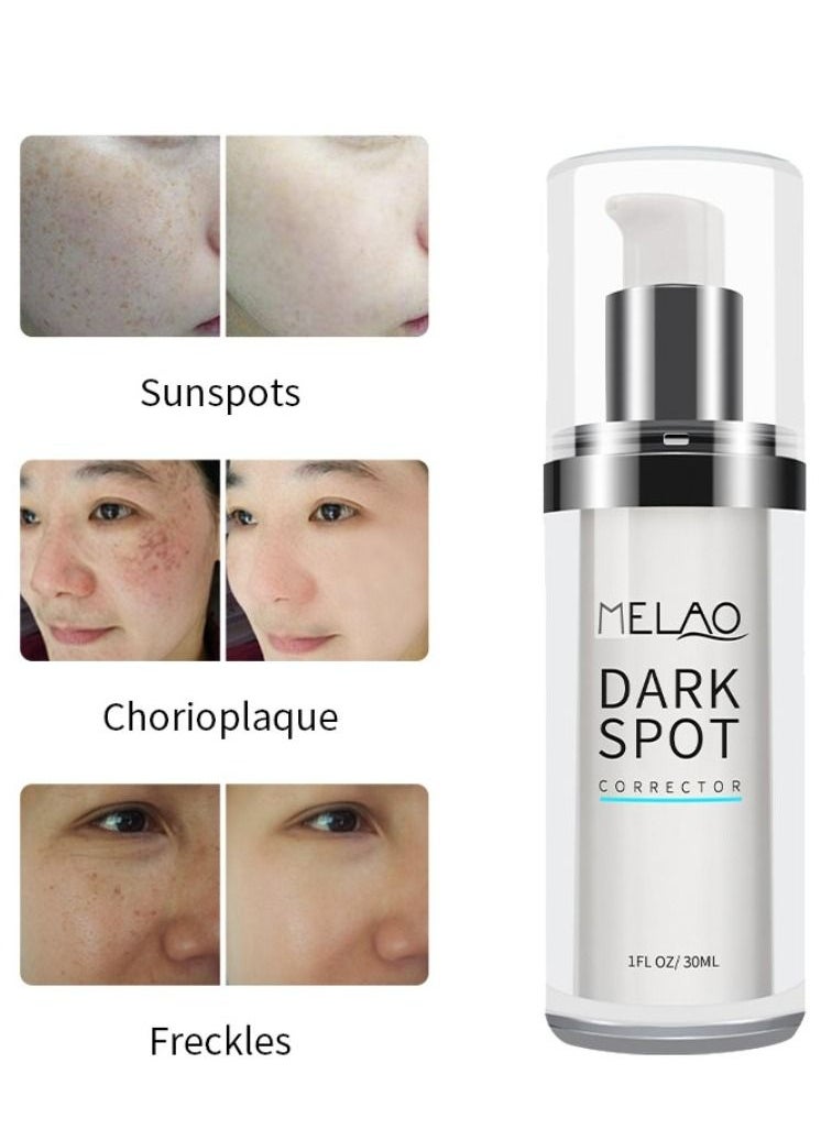 MELAO - Dark Spots Corrector Remover Keeps Hydrate and Smooth Skin 30ml - Image 1