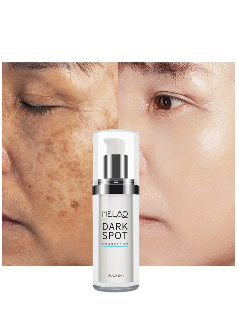 MELAO - Dark Spots Corrector Remover Keeps Hydrate and Smooth Skin 30ml - Image 1