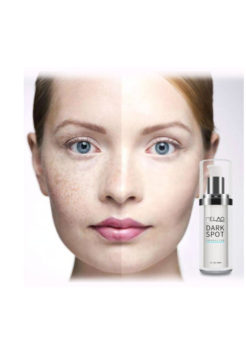 MELAO - Dark Spots Corrector Remover Keeps Hydrate and Smooth Skin 30ml - Image 1