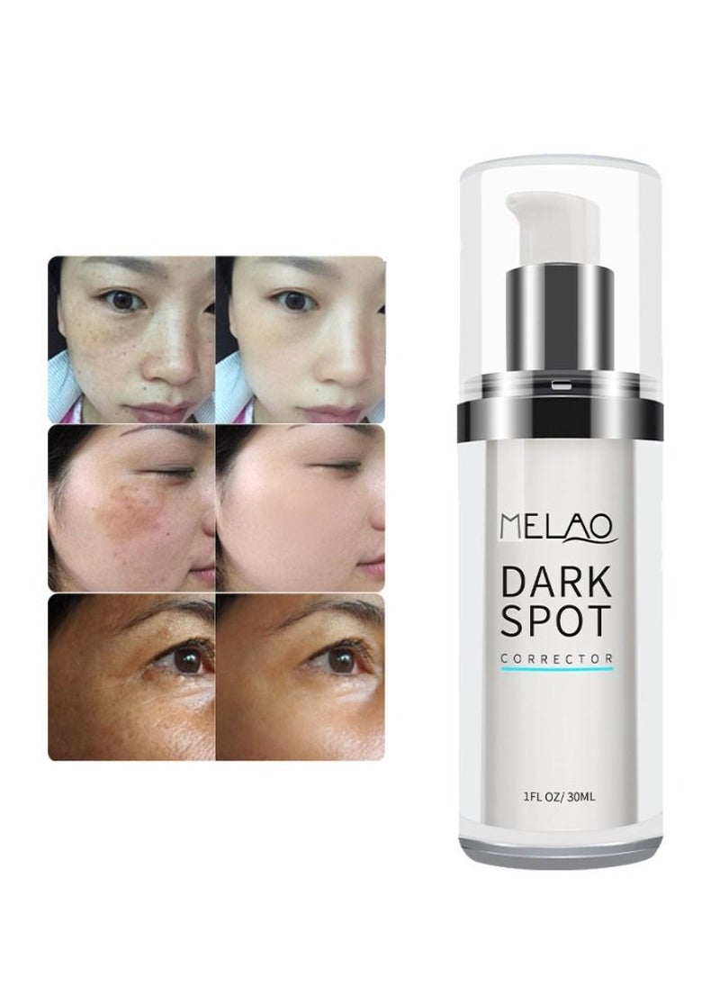 MELAO - Dark Spots Corrector Remover Keeps Hydrate and Smooth Skin 30ml - Image 1
