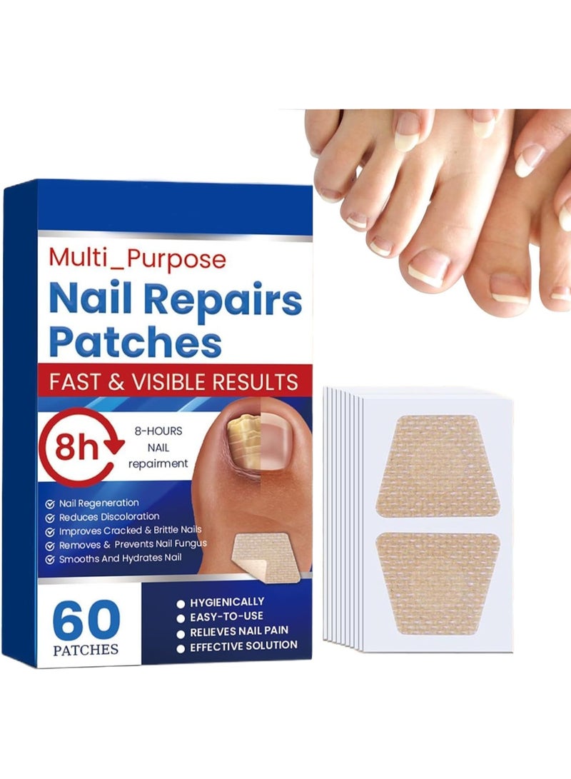 كيلا 60 قطعة من لاصقات الأظافر، للعناية بأظافر القدمين وأظافر اليدين، ملصق لإصلاح الأظافر طوال الليل، لاصقات أظافر القدم الفعالة للرجال والنساء للتعافي والاستعادة - Image 1