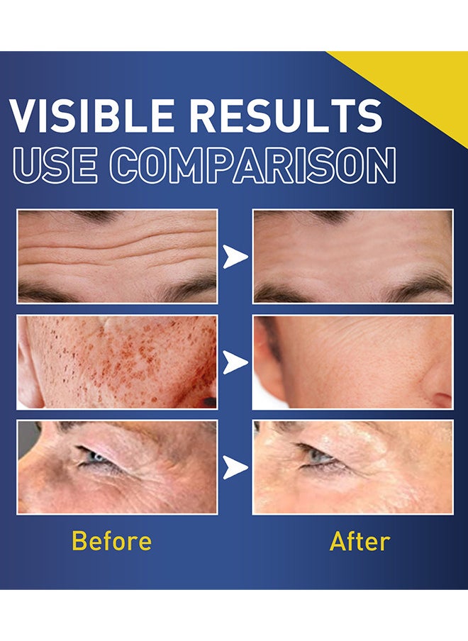 East Moon - Point Care Cream Improve Dull Skin, Men's Moisturizing Anti-Aging Cream, Men's Face Moisturizer Point Care Cream, Improving Wrinkles And Anti-Aging, Deeply Moisturize The Skin, Skin Firming And Tighten - Image 1